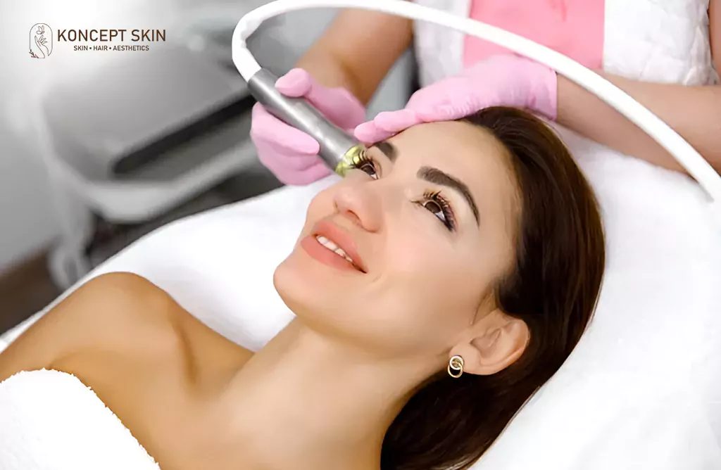 Clear Skin After Acne Treatment Boosts Self-Confidence